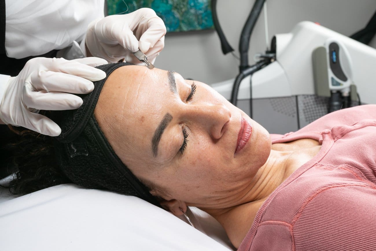 Cincinnati Dermaplaning Treatments