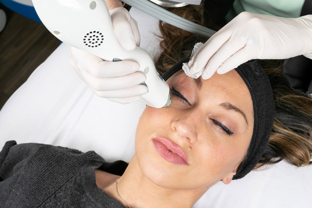 Cincinnati Thermage Treatments