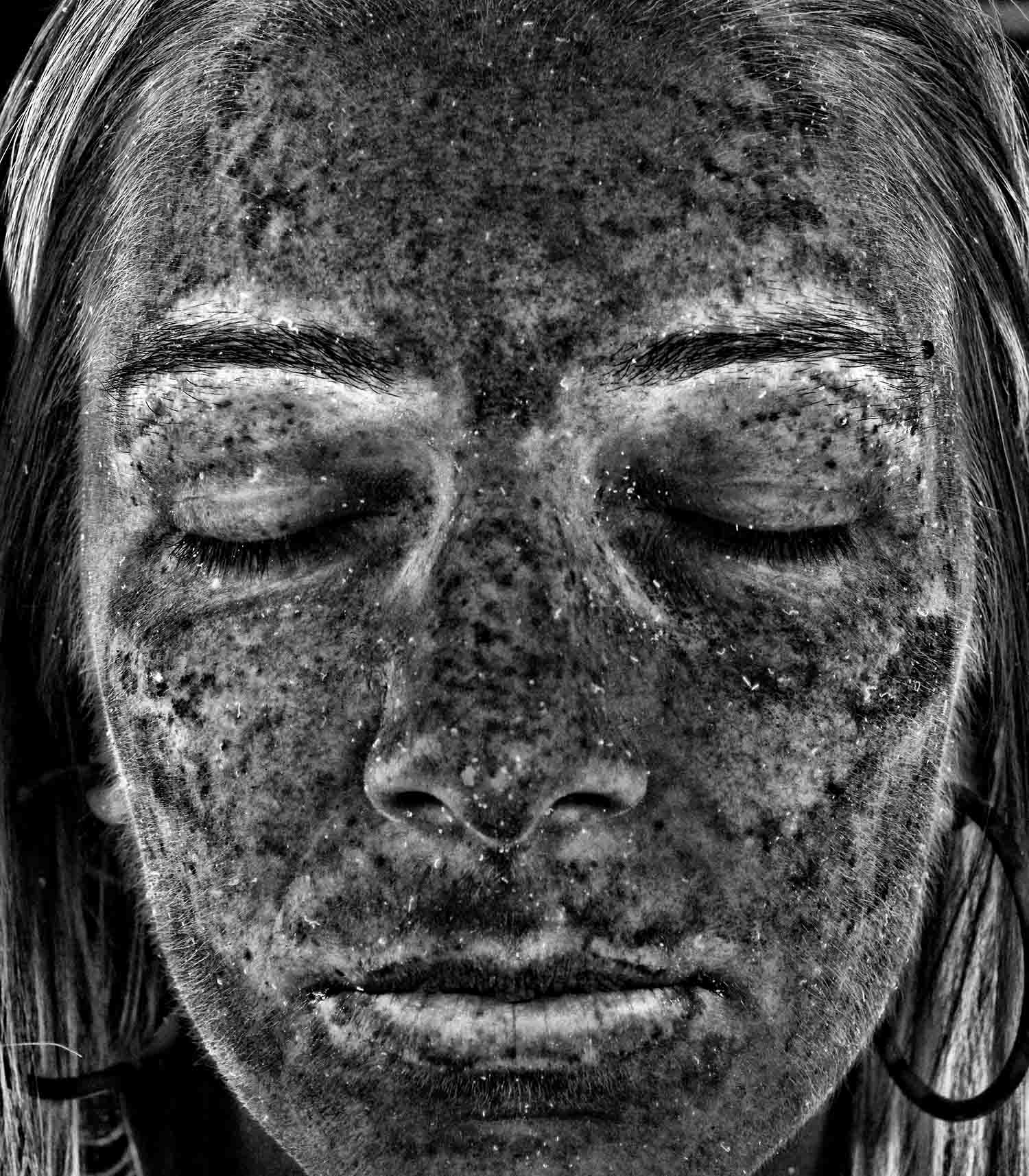 Schmidt, Amanda 20180315143233000 UV Spots copy Cincinnati VISIA Complexion Anlysis