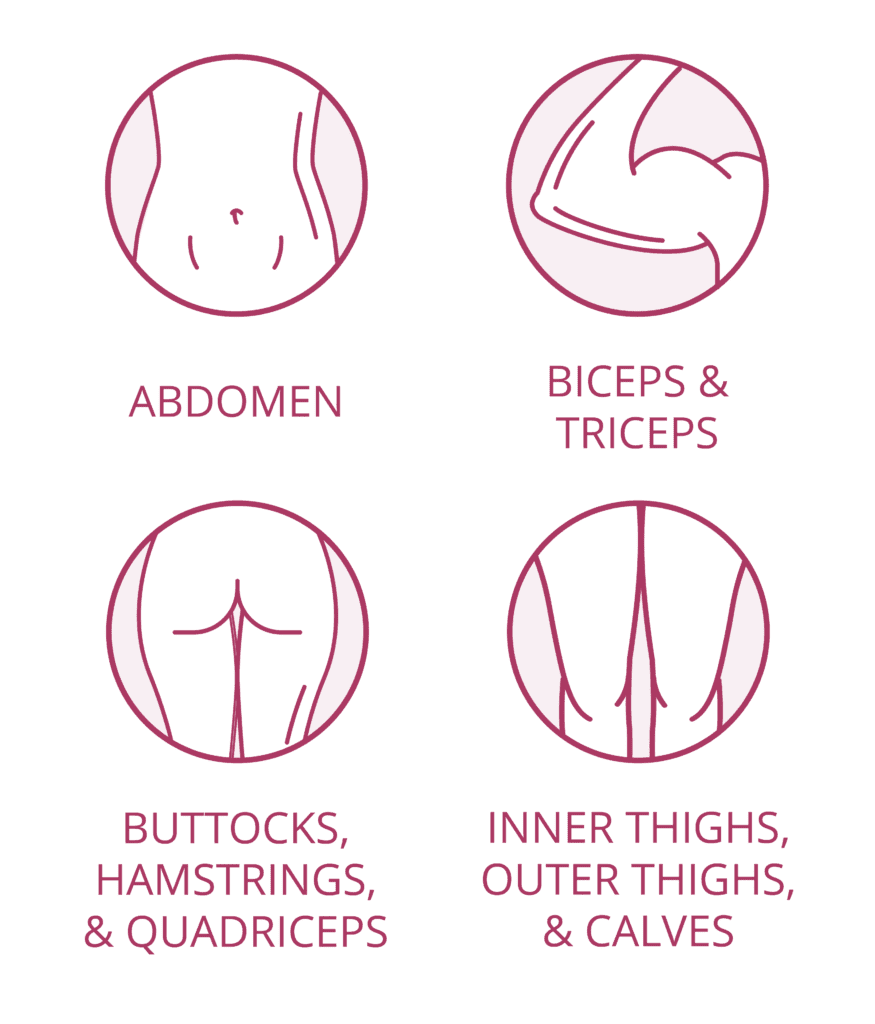 Emsculpt neo Cincinnati treatment areas