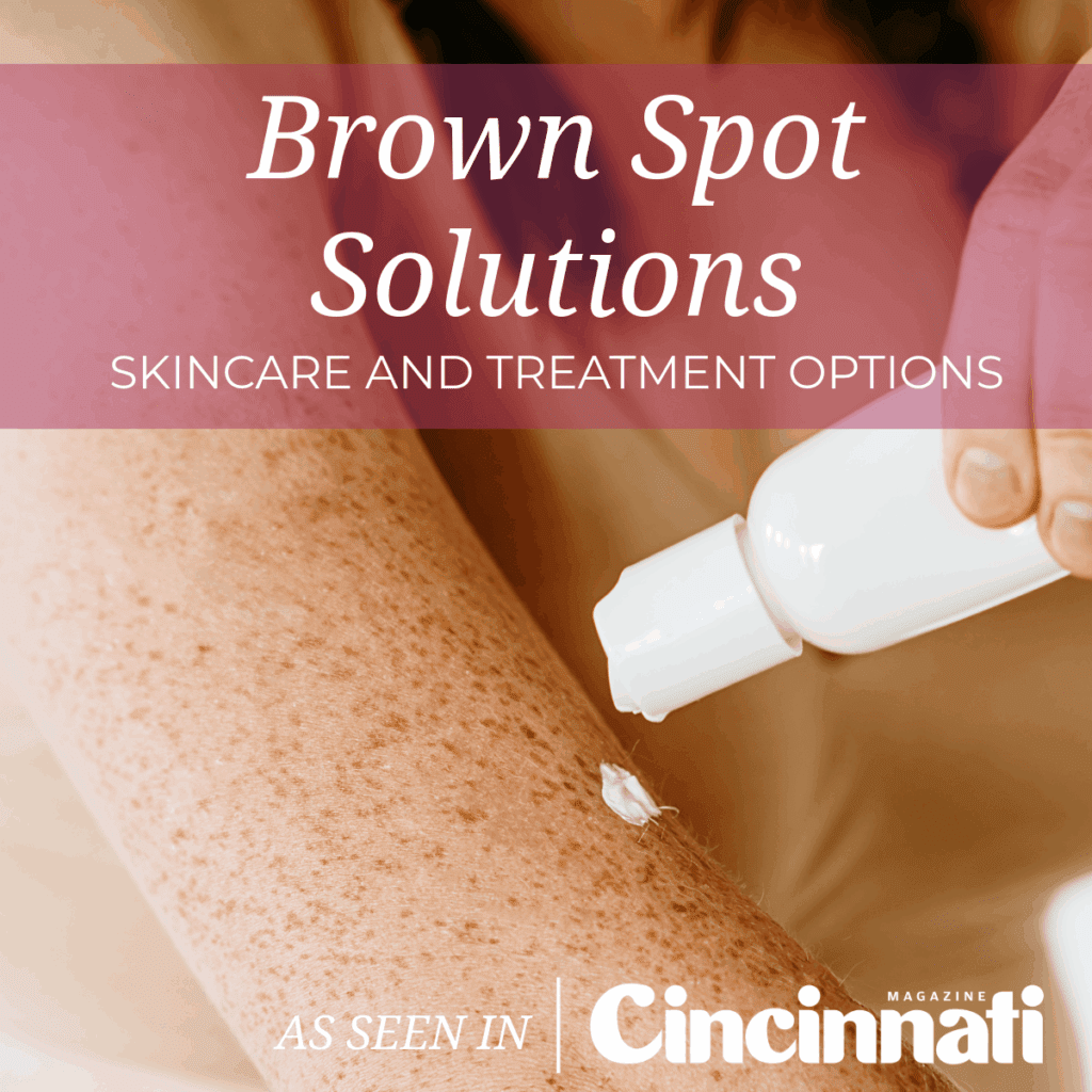 Brown Spot Solutions: Skincare and Treatment Options