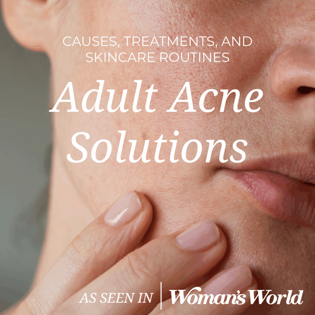 Adult Acne Solutions: Causes, Treatments, and Skincare Routines