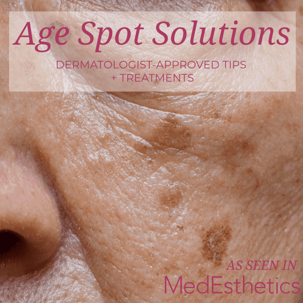 Age Spot Solutions: Dermatologist-Approved Tips & Treatments