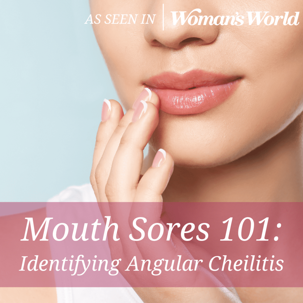 Mouth Sores 101: Identifying Angular Cheilitis
