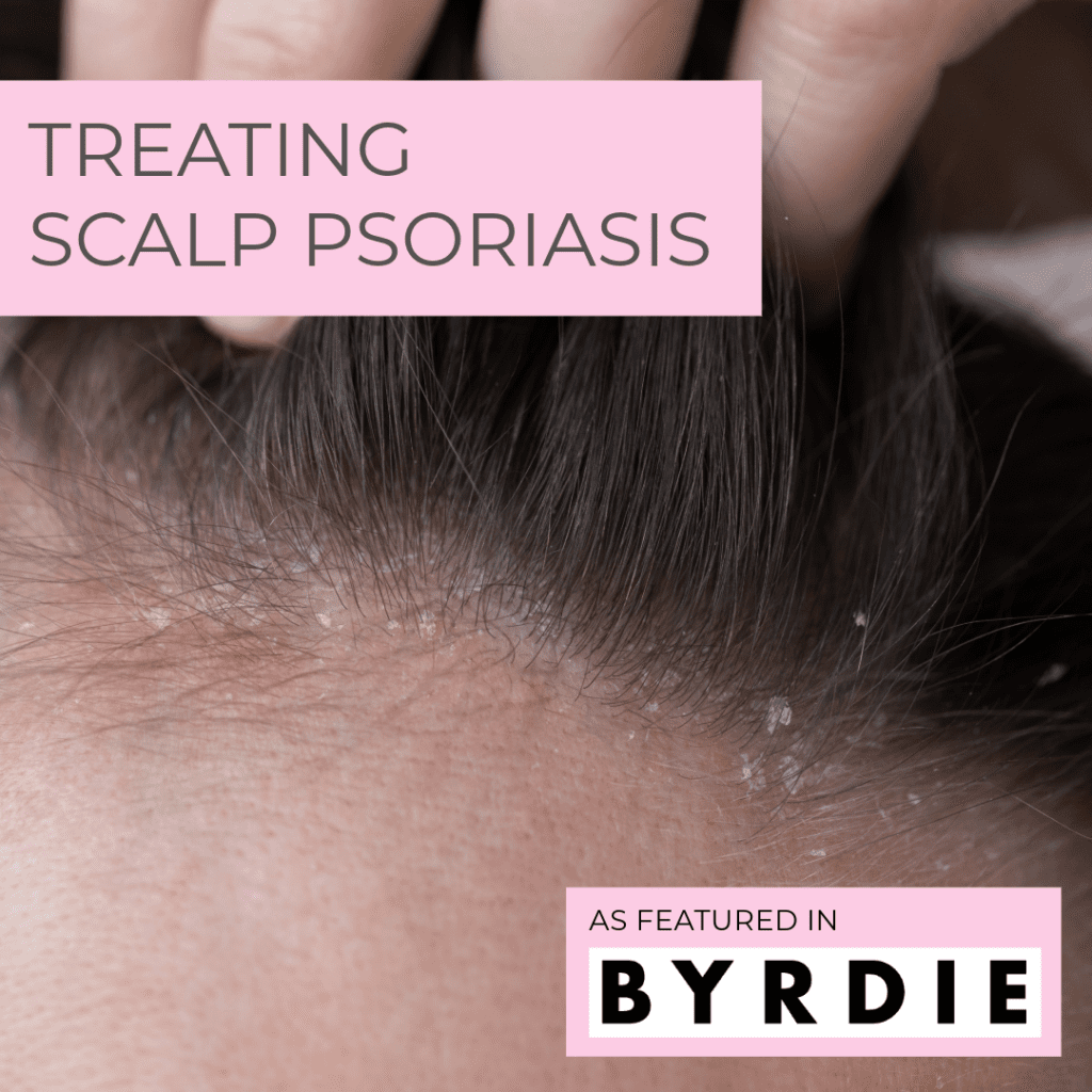 scalp psoriasis