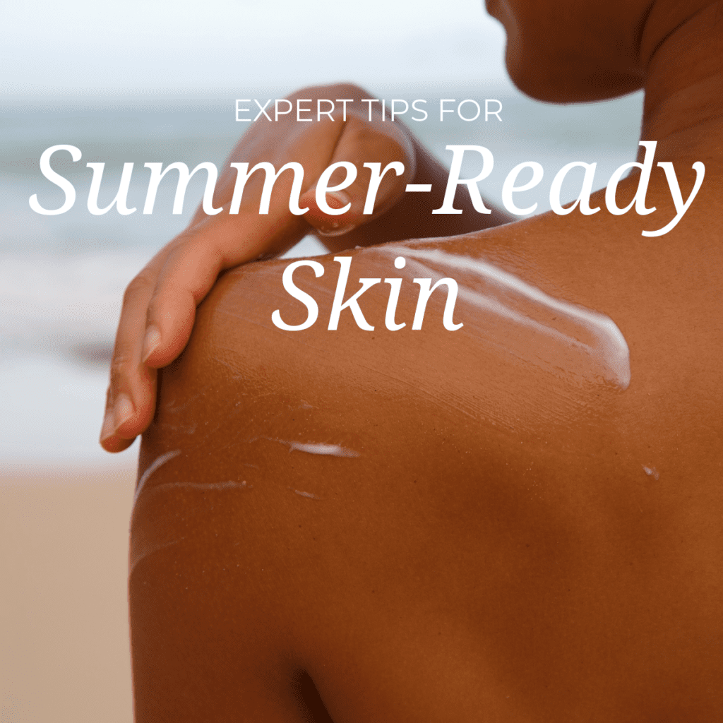 Expert Tips for Summer-Ready Skin