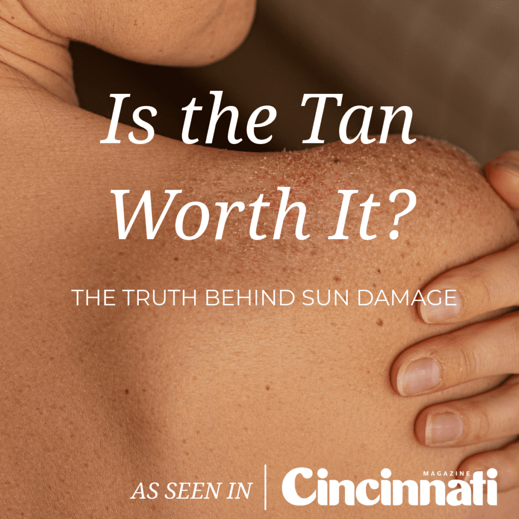 Is the Tan Worth It? The Truth Behind Sun Damage