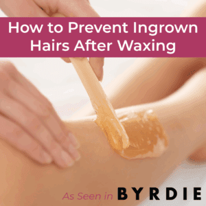 ingrown hairs