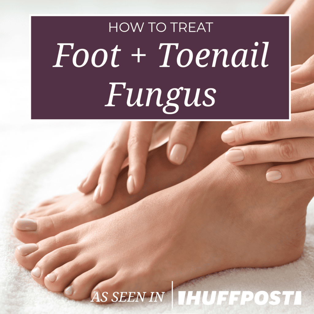 How to Treat Foot and Toenail Fungus