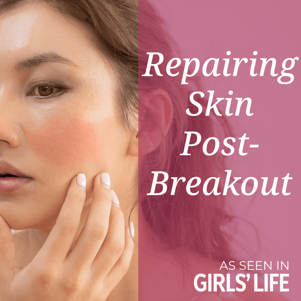 Repairing Skin Post-Breakout