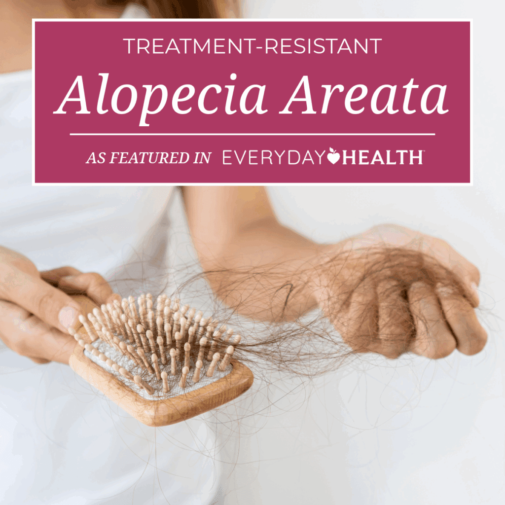 Finding Support For Treatment-Resistant Alopecia Areata
