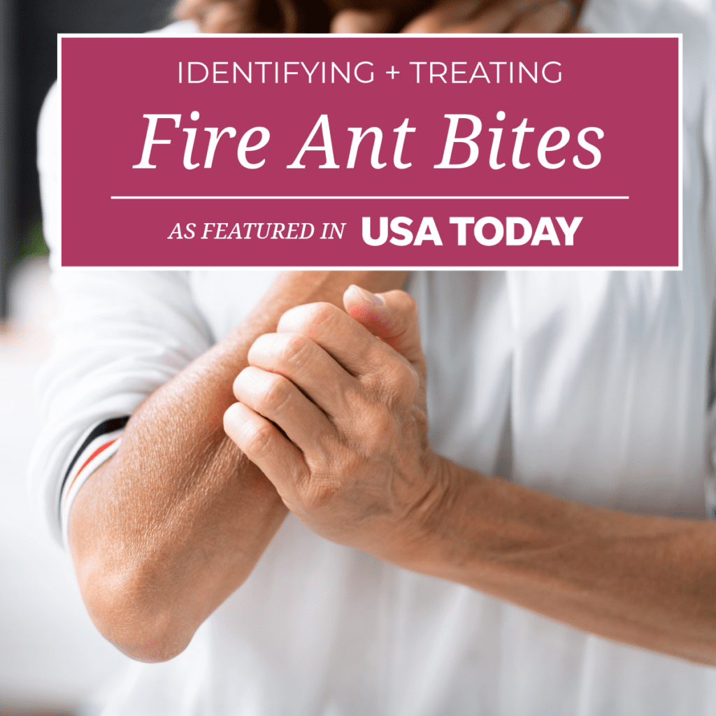 Identifying and Treating Fire Ant Bites