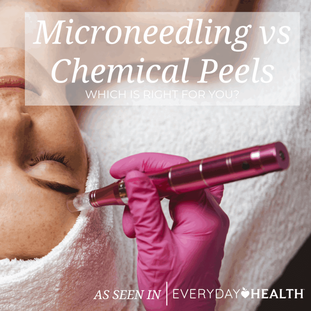 Microneedling vs Chemical Peels