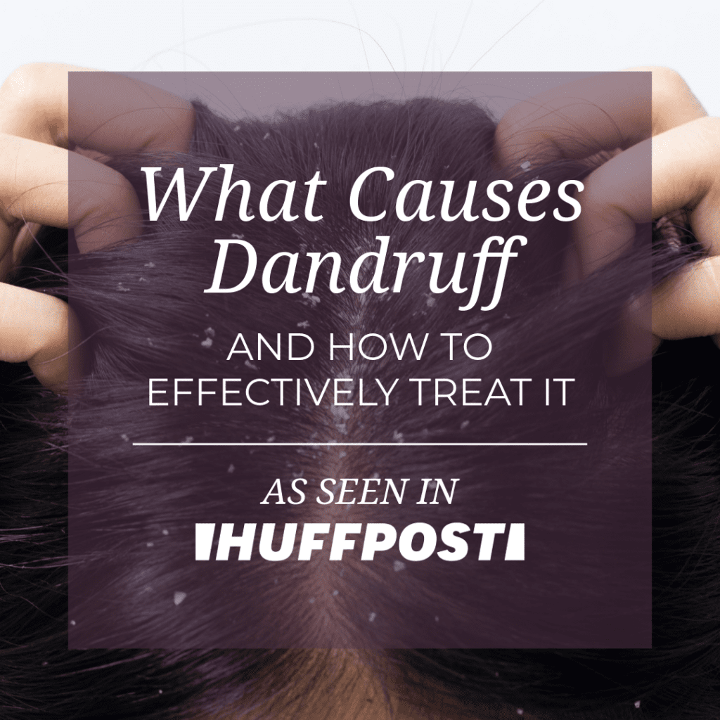 dandruff