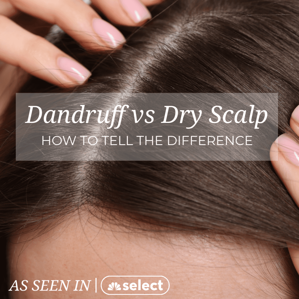 dry scalp vs dandruff