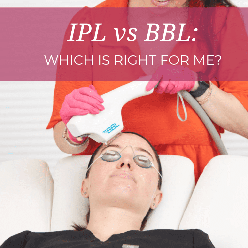 ipl vs bbl