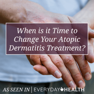 When is it Time to Change Your Atopic Dermatitis Treatment?