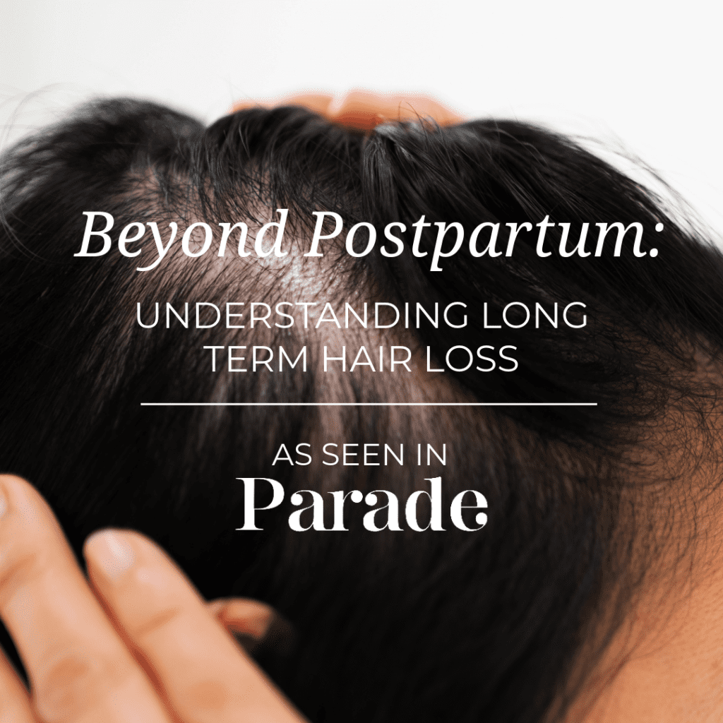 postpartum hair loss
