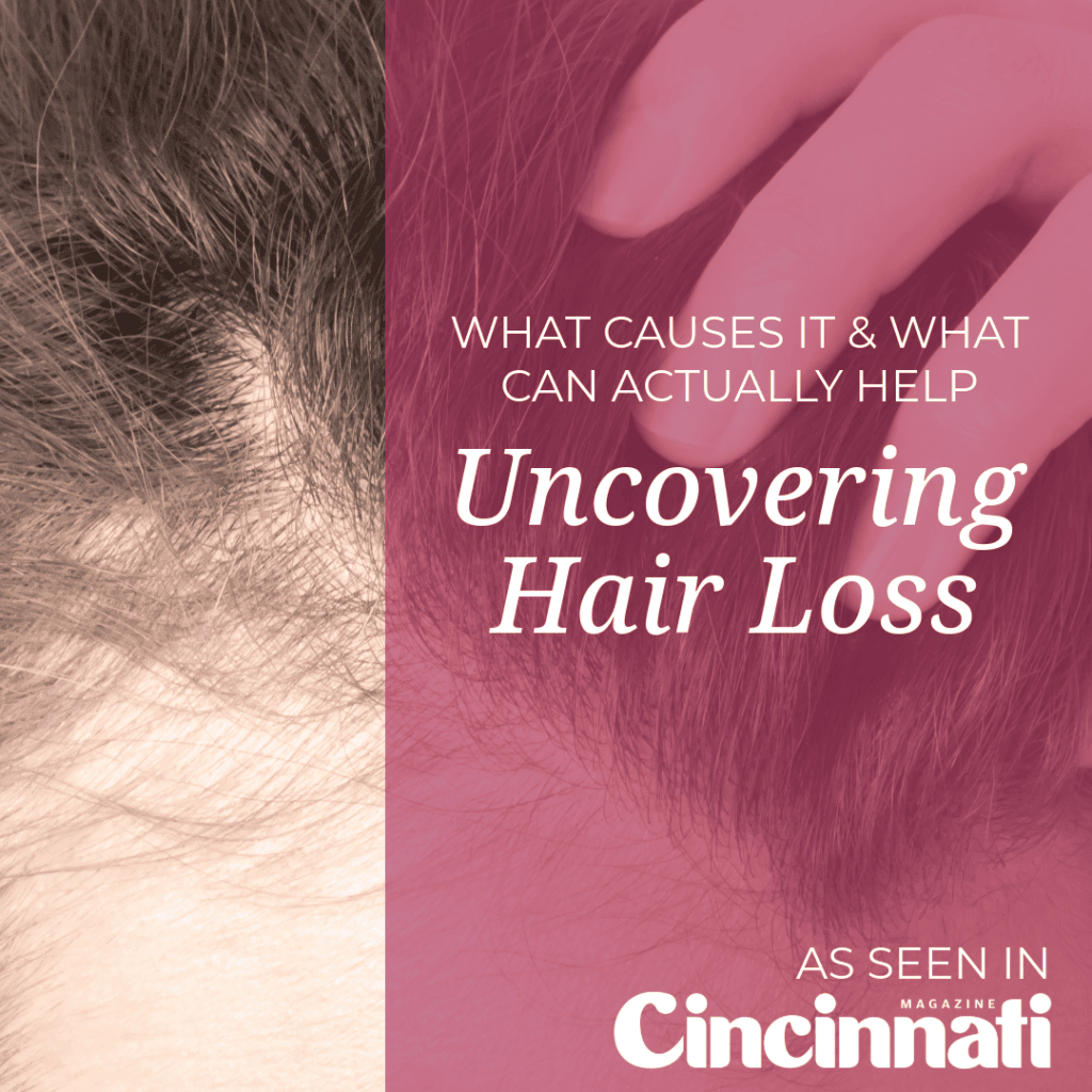 Hair Loss -Cincinnati Magazine