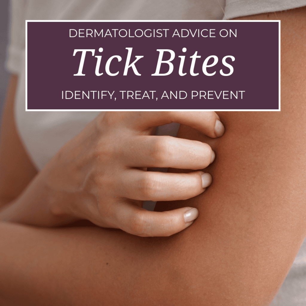 Dermatologist advice on how to identify, treat, and prevent tick bites.