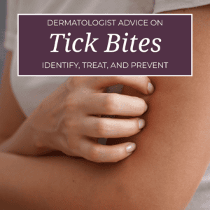 Dermatologist advice on how to identify, treat, and prevent tick bites.