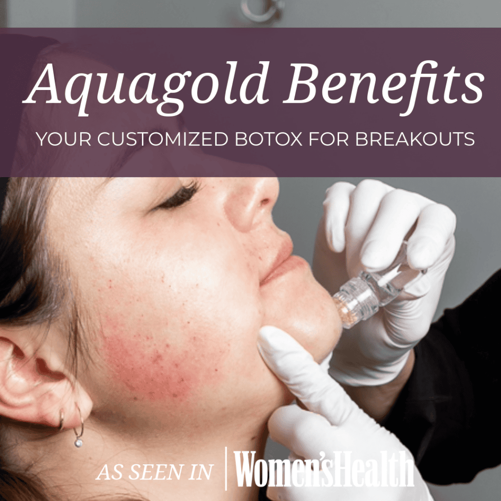 Aquagold Benefits, Your customized botox for breakouts