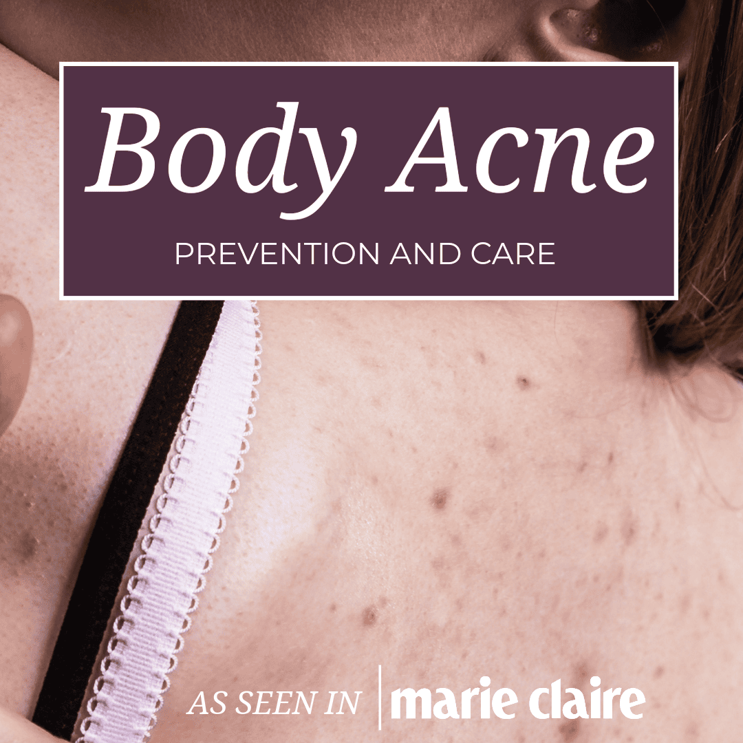 Body Acne Prevention and Care